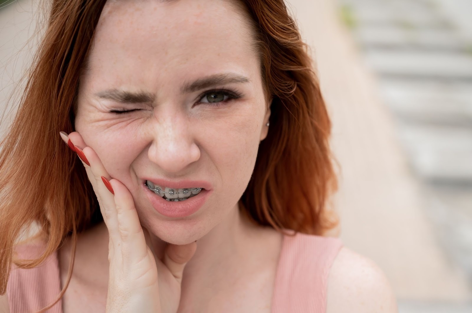 How to Manage Discomfort with Braces